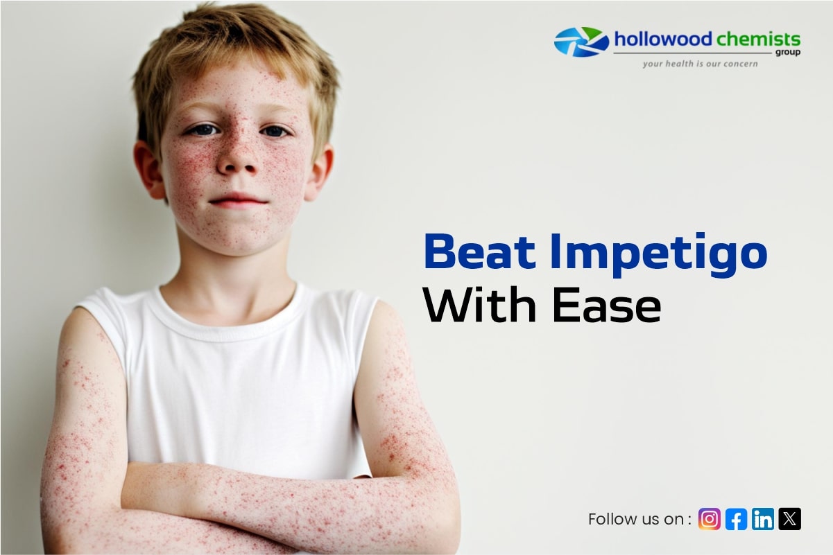 Dealing with Impetigo: How Your Pharmacy Can Help