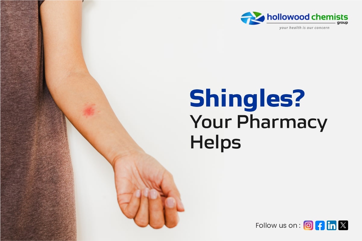 Treating Shingles: Medication and Support Available at Your Local Pharmacy