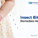 Insect Bites: Immediate Relief and Prevention Tips from Your Pharmacist