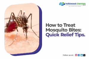How to Treat Mosquito Bites: Quick Relief Tips.